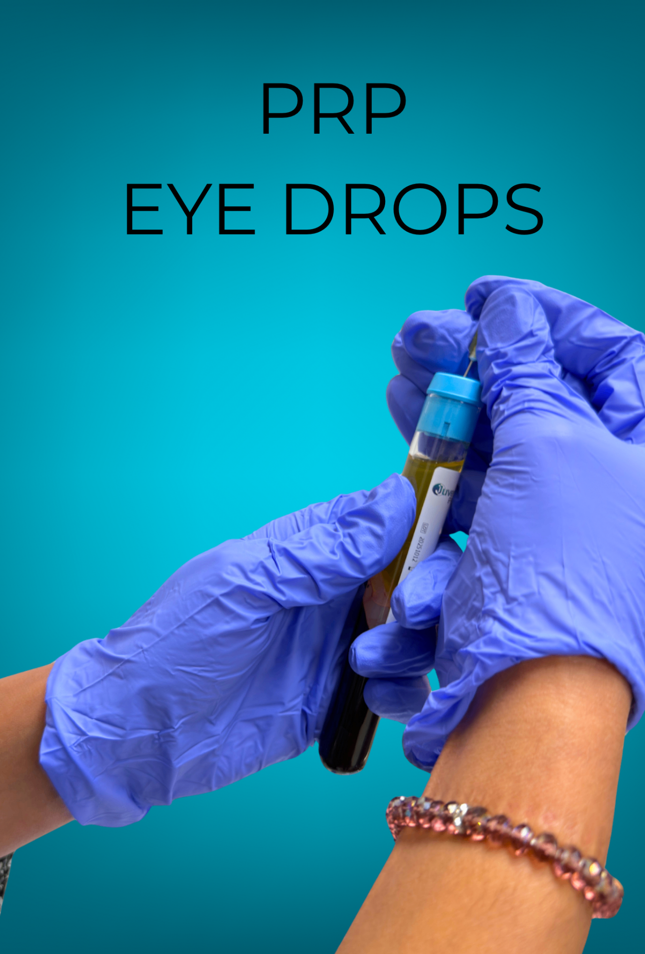 Platelet-Rich Plasma (PRP) Eye Drops for dry eye treatment at Carousel Eyecare
